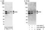 NFIB Polyclonal Antibody
