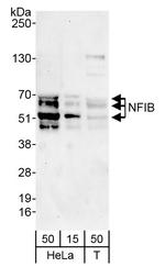 NFIB Polyclonal Antibody