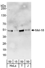 Mel-18 Polyclonal Antibody