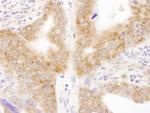 RPL6 Polyclonal Antibody