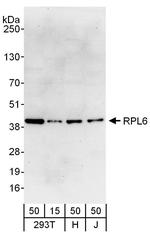 RPL6 Polyclonal Antibody
