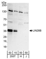 LIN28B Polyclonal Antibody