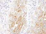 LIN28B Polyclonal Antibody