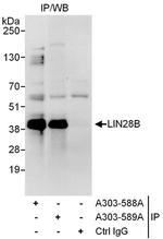 LIN28B Antibody in Immunoprecipitation (IP)