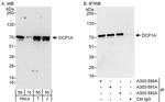 DCP1A Antibody in Western Blot (WB)