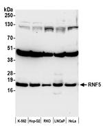 RNF5 Polyclonal Antibody