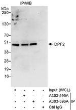 DPF2 Polyclonal Antibody