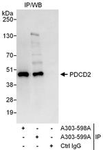 PDCD2 Polyclonal Antibody