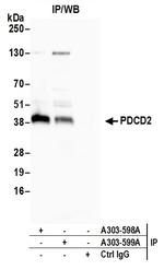PDCD2 Antibody in Immunoprecipitation (IP)