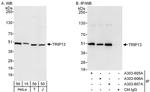 TRIP13 Polyclonal Antibody