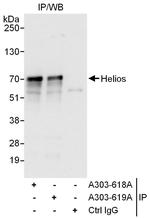 Helios Antibody in Immunoprecipitation (IP)