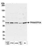 TFIIIA/GTF3A Polyclonal Antibody