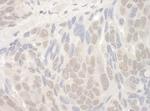THOC2 Polyclonal Antibody