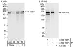 THOC2 Antibody in Western Blot (WB)