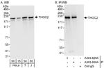 THOC2 Antibody in Western Blot (WB)