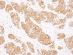 COMT Polyclonal Antibody