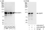 AGGF1 Polyclonal Antibody