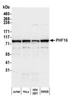 PHF16 Polyclonal Antibody