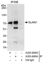 SLAIN1 Polyclonal Antibody