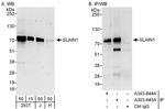 SLAIN1 Polyclonal Antibody