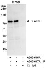SLAIN2 Polyclonal Antibody