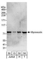 Myoneurin Polyclonal Antibody
