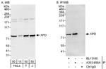 XPD Polyclonal Antibody