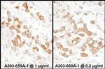 PKM2 Antibody in Immunohistochemistry (Paraffin) (IHC (P))