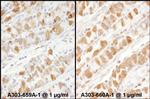 PKM2 Antibody in Immunohistochemistry (Paraffin) (IHC (P))
