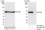 PKM2 Antibody in Western Blot (WB)