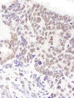 SRp55 Antibody in Immunohistochemistry (Paraffin) (IHC (P))