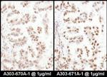 SRp75 Polyclonal Antibody