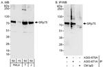 SRp75 Antibody in Western Blot (WB)