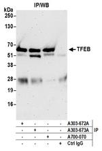 TFEB Antibody in Immunoprecipitation (IP)