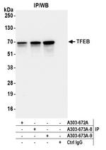 TFEB Antibody in Immunoprecipitation (IP)