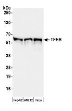 TFEB Antibody in Western Blot (WB)