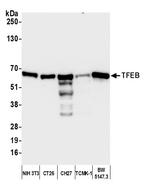 TFEB Polyclonal Antibody
