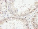 ETV6 Polyclonal Antibody