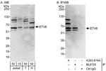 ETV6 Antibody in Western Blot (WB)