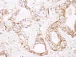 Bcl-2 Polyclonal Antibody