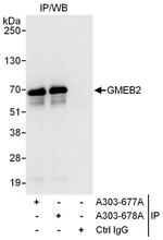 GMEB2 Antibody in Immunoprecipitation (IP)