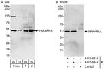PRKAR1A Polyclonal Antibody