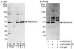PRKAR1A Polyclonal Antibody