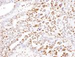 SAMHD1 Polyclonal Antibody