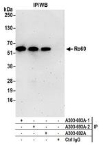 Ro60 Antibody in Immunoprecipitation (IP)