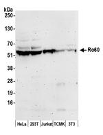 Ro60 Polyclonal Antibody