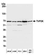 ZBTB7B Polyclonal Antibody