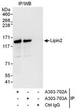 Lipin2 Polyclonal Antibody
