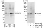 POLR3E Polyclonal Antibody
