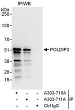 POLDIP3 Polyclonal Antibody
